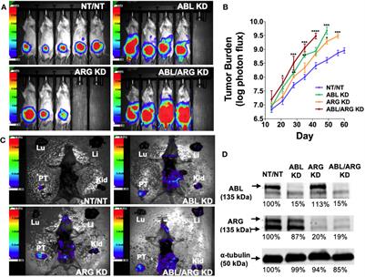 Abl kinases can function as suppressors of tumor progression and metastasis